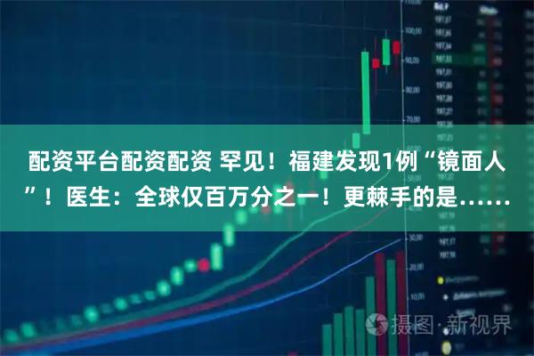 配资平台配资配资 罕见!福建发现1例“镜面人”!医生:全球仅百万分之一!更棘手的是……